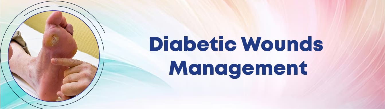 Diabetic Wounds Management